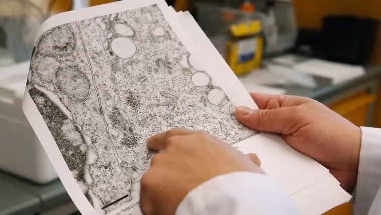 Loai virus gay dich moi, trieu chung co the giong dot quy