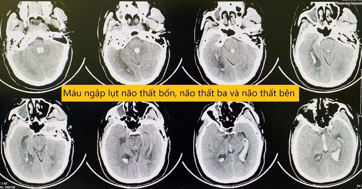 Nguoi dan ong bi dot quy khi dang ngoi lam viec