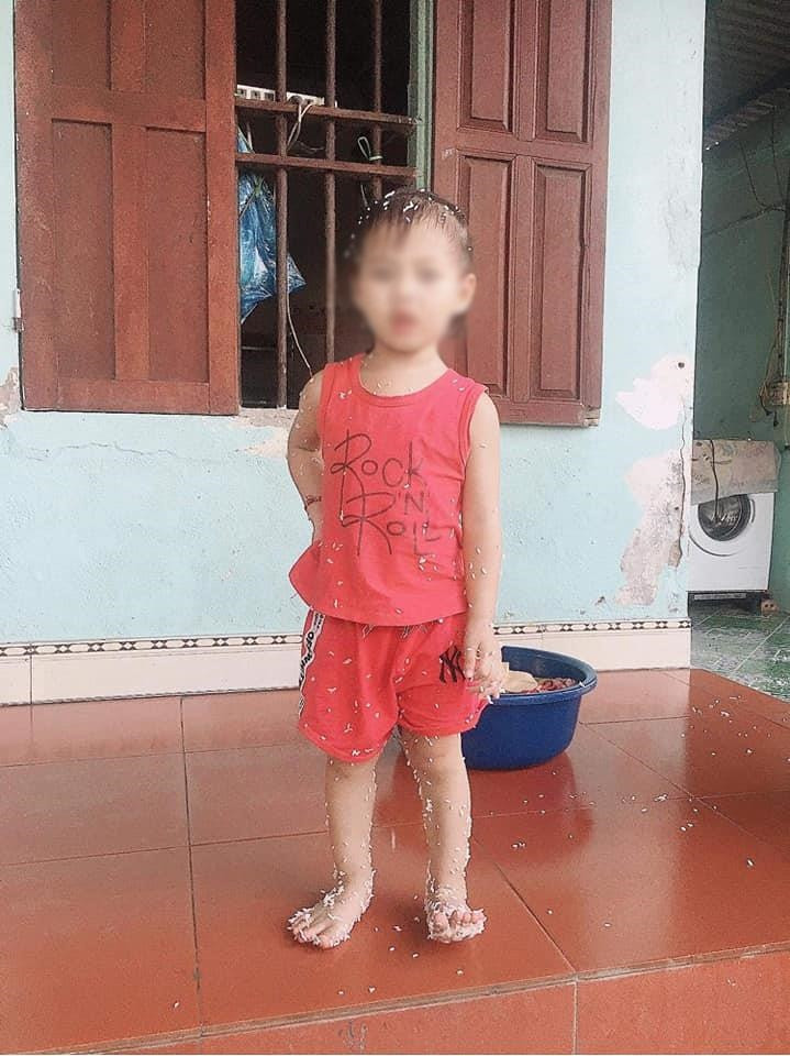 Đang đi tự nhiên nồi cơm va vào người.