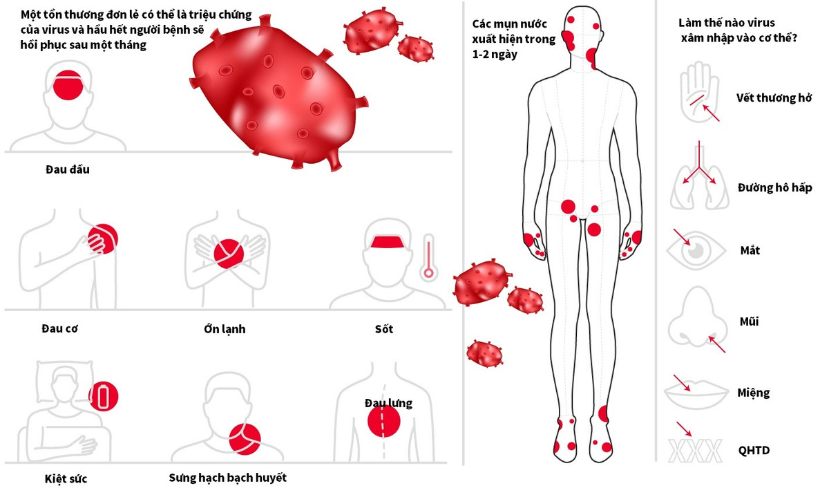 Anh phat hien bien chung virus dau mua khi moi