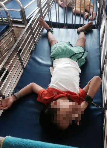 Các đứa trẻ bị bại não, thần kinh phải cột tứ chi để tránh những lần lên cơn gây hại cho bản thân.