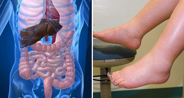 Biểu hiện nội tạng của bạn nhiễm bẩn nghiêm trọng cần thải độc gấp Bieu hien noi tang cua ban nhiem ban nghiem trong can thai doc gap