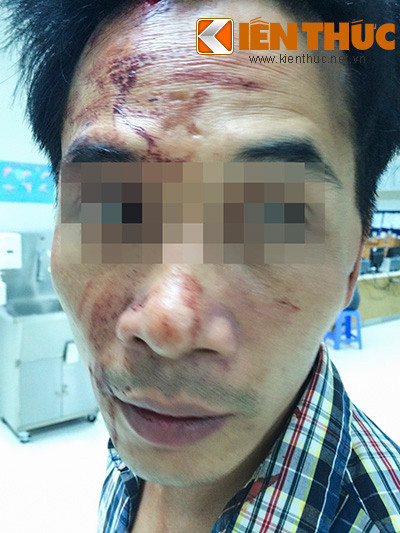 Khi nhóm bảo vệ dân phố yêu cầu xuất trình giấy CMTND, anh Thịnh đưa tờ giấy hẹn ra thì bị Phan Cao Sơn (tổ trưởng tổ dân phố) quát mắng và dùng đèn pin đánh mạnh vào đầu và mặt gây chảy máu.