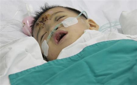 Thiên Bảo những ngày được các bác sĩ giành lại mạng sống từ tay tử thần