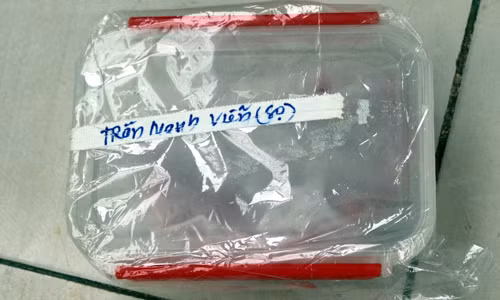 Hộp sọ của nạn nhân Viễn bị vỡ.