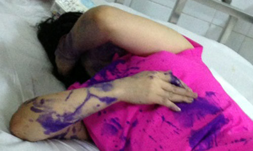 Chị Hằng đang điều trị tại bệnh viện.