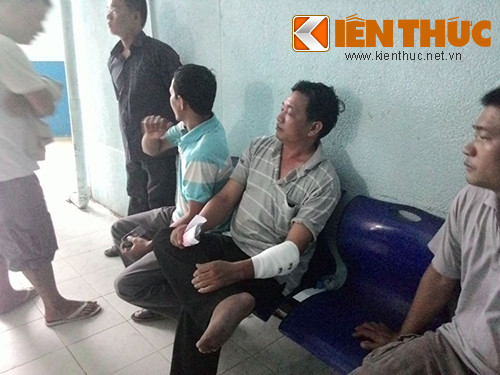 Anh Vũ Đức G.(áo sọc kẻ ngang ngồi giữa) phải khâu hơn chục mũi ở cánh tay trái. Anh Vũ Đức G.(áo sọc kẻ ngang ngồi giữa) phải khâu hơn chục mũi ở cánh tay trái.