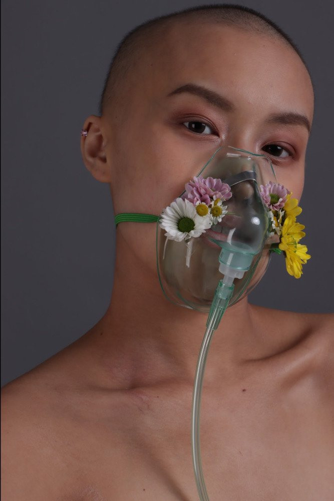 Thay doi muc tieu song sau khi danh bai ung thu-Hinh-3