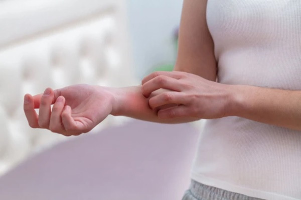 4 bat thuong tren da xuat hien can de phong ung thu gan-Hinh-5