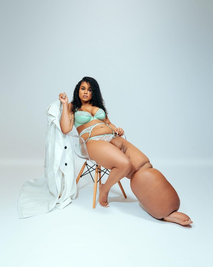 Co gai so huu chan trai nang 45 kg tro thanh nguoi mau-Hinh-8