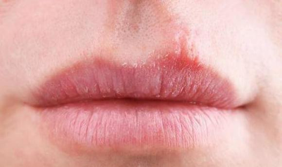 Mieng bi kho khi ngu co the lien quan den 4 dieu nay-Hinh-3