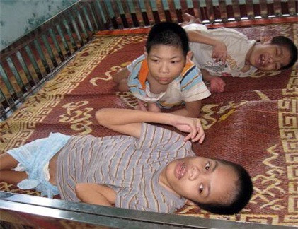 Trong năm 2012 - 2013, Phạm Ngọc Thành - Giám đốc Trung tâm cứu trợ trẻ em tàn tật, thuộc Sở Lao động, Thương binh và Xã hội tỉnh Hà Giang cùng hai "cộng sự" Nguyễn Thị Lan Anh (kế toán), Trịnh Thu Hương (thủ quỹ) đã "ăn bớt" của trẻ khuyết tật hơn 180 triệu đồng. Ảnh minh họa.