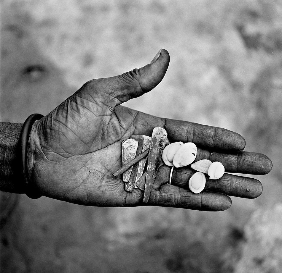 Hầu hết dụng cụ xăm mình đều thô sơ và không được khử trùng. Các nhân viên y tế đã cảnh báo, tuyên truyền rằng dụng cụ tạo sẹo phải được sát khuẩn kỹ càng nhưng nhiều thủ lĩnh bộ lạc đã bỏ ngoài tai những lời khuyên đó.