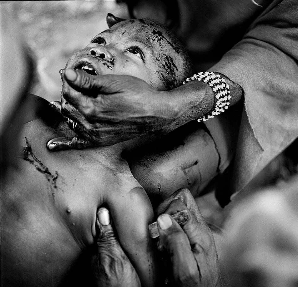 Hiện, một số quốc gia Tây Phi đã cấm hủ tục này, bởi hành động rạch lên mặt hay lên cơ thể trẻ em được coi là man rợ, vi phạm quyền trẻ em nghiêm trọng. Tuy nhiên, trong tâm thức của những người dân ở vài bộ lạc, họ cho rằng những vết sẹo trên mặt là niềm tự hào khi được công nhận thành viên của bộ lạc, những vết cắt trên lưng hay trên bụng thể hiện lòng can đảm.