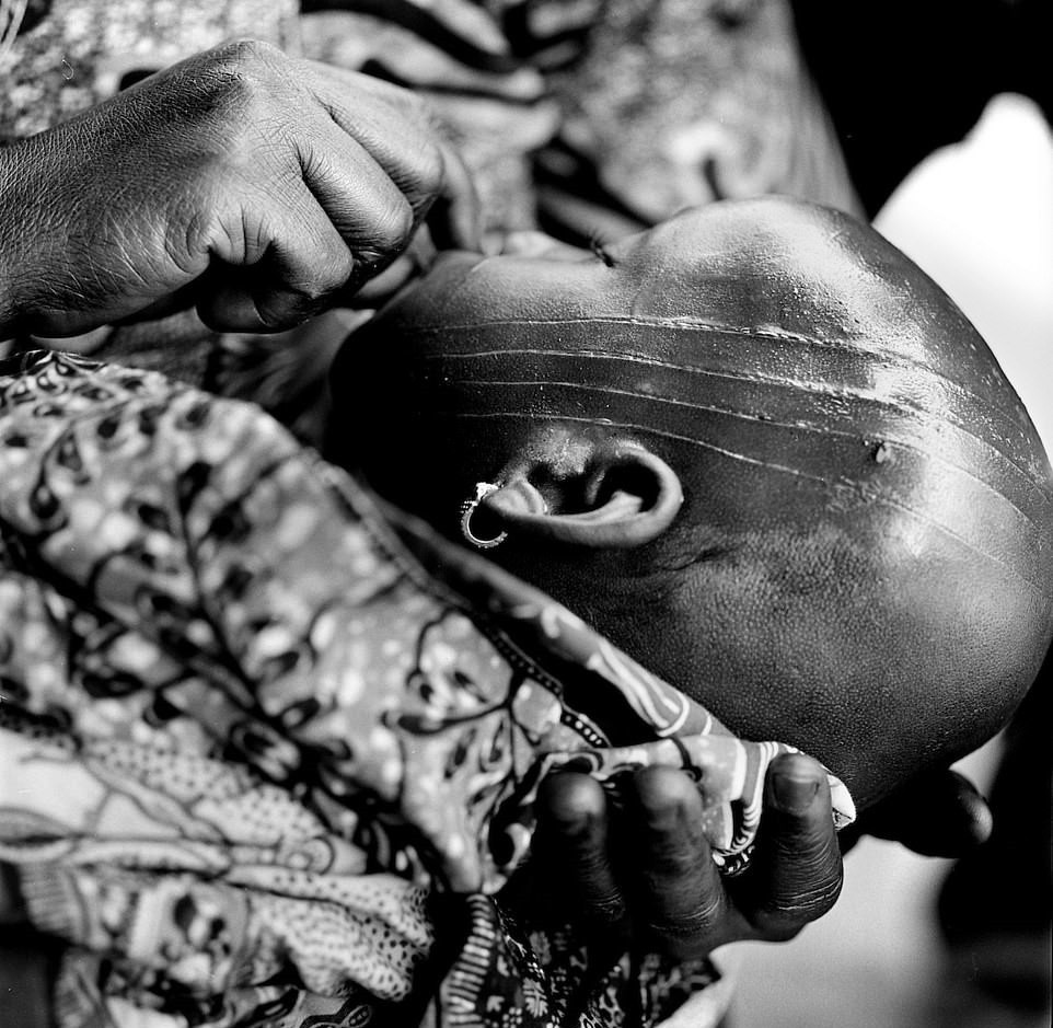 Dân tộc Houeda, một bộ lạc ở Bénin, Tây Phi tin rằng những đứa trẻ có sẹo trên khuôn mặt sẽ kết nối được với tổ tiên của chúng. Sau buổi lễ rạch cơ thể, những đứa trẻ được đặt tên mới, tóc bị cạo đi và được đưa đến tu viện để thực hành nghi lễ giao tiếp với tổ tiên. Tuy nhiên, ngày nay tập tục này đang lụi tàn dần bởi tại các thành phố lớn ở Bénin, người dân thường kỳ thị những ai có sẹo trên mặt.