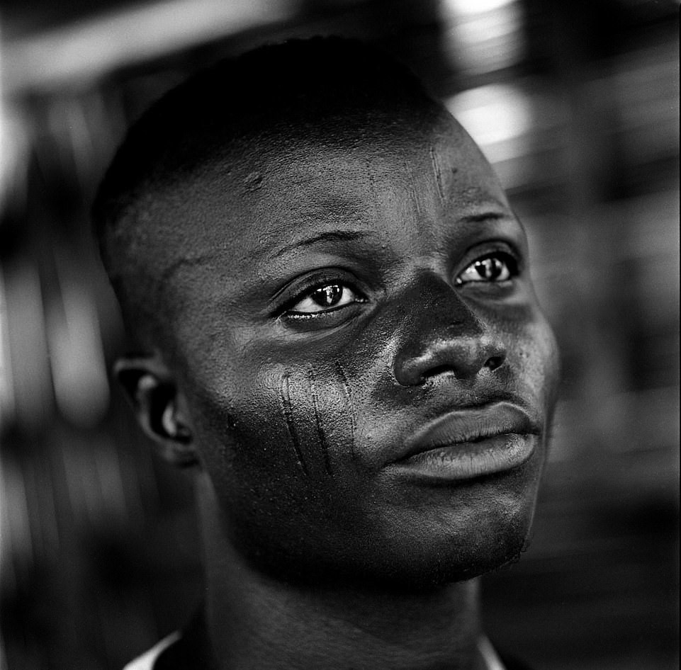 Theo phong tục của bộ lạc Betamarribe ở Bénin, những người lớn tuổi, được gọi là Somba hoặc Tammari, nói rằng một đứa trẻ không có sẹo không phải là con người.