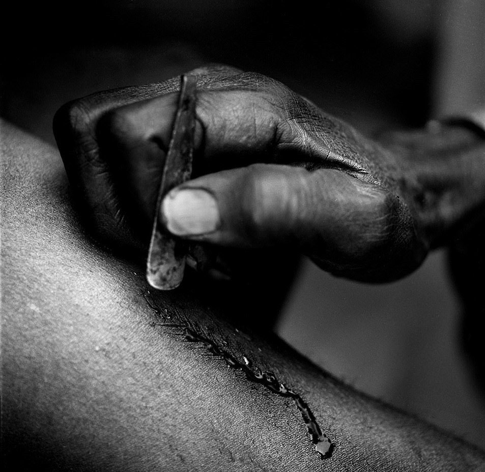 Tuy nhiên, có không ít những người đã từ chối truyền thống của tổ tiên bởi họ nhận thức được những bệnh nguy hiểm có thể gây ra bởi những vết sẹo như HIV, uốn ván hay nhiễm trùng. Họ nghĩ rằng để bảo tồn di sản, văn hóa truyền thống, thay vì rạch mặt có thể giữ gìn trang phục, ngôn ngữ, các lễ hội hay tôn giáo.