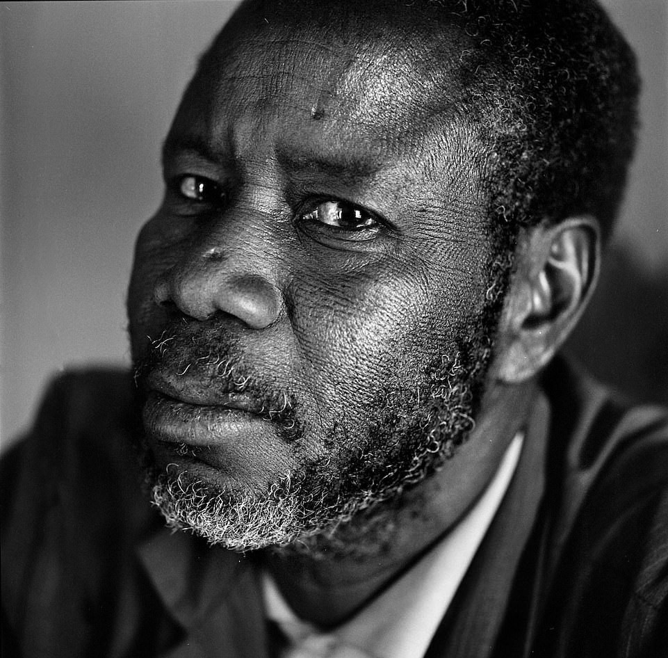 Các thành viên lớn tuổi trong bộ lạc được tôn kính vì những vết sẹo chằng chịt trên mặt, trên cơ thể, nhưng tại các thành phố lớn ở Tây Phi, nhiều người có sẹo sẽ cảm thấy xấu hổ khi bị kỳ thị.