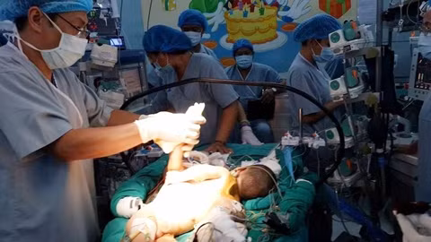 Các bác sĩ đang tiến hành ca mổ. Ảnh: VNN