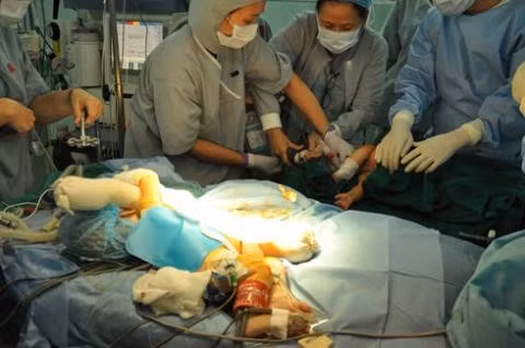 Các bác sĩ Bệnh viện Nhi Đồng 2 mổ tách cặp song sinh gái 4 tháng tuổi cuối năm 2012. Ảnh: Internet.