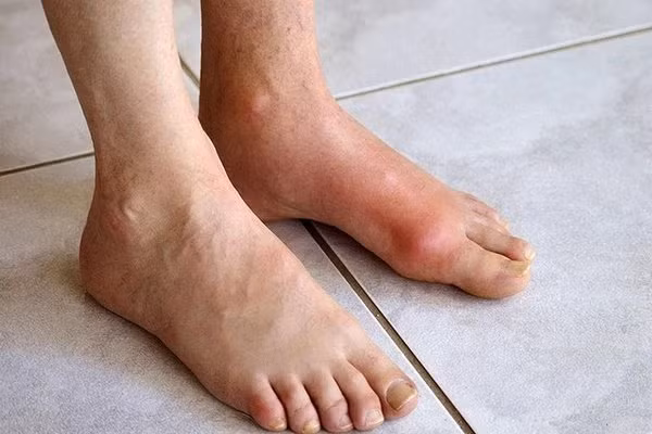 7 nguy hai doi voi suc khoe khi Tet an nhieu banh keo, nuoc ngot-Hinh-3