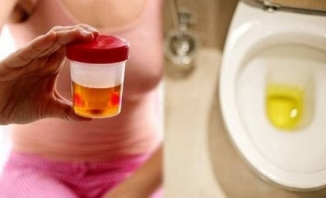 3 bộ phận trên cơ thể bốc mùi hôi chứng tỏ gan đang kêu cứu - Hình 2 3 bo phan tren co the boc mui hoi chung to gan dang keu cuu-Hinh-2