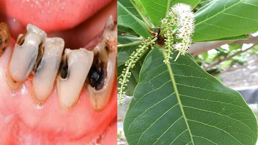 Lá bàng đun nóng: Hiệu quả từ đau răng, nhiệt miệng đến... viêm vùng kín - Hình 2 La bang dun nong: Hieu qua tu dau rang, nhiet mieng den... viem vung kin-Hinh-2