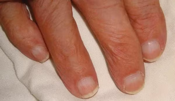 Quan sat mau mong tay co the biet tinh trang than