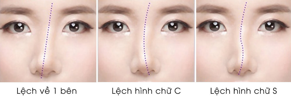 Họ thường hành động vượt xa quy chuẩn mẫu mực và dễ bị vật chất làm lu mờ ý chí. Khi có tiền trong tay, những người này sẽ vung tay quá trớn, tiền mất tật mang là điều không tránh khỏi. 