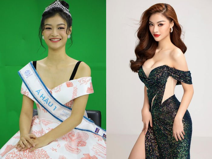 Tăng size vòng 1 bất thường, Kỳ Duyên thừa nhận đã thẩm mỹ - Hình 6 Tang size vong 1 bat thuong, Ky Duyen thua nhan da tham my-Hinh-6