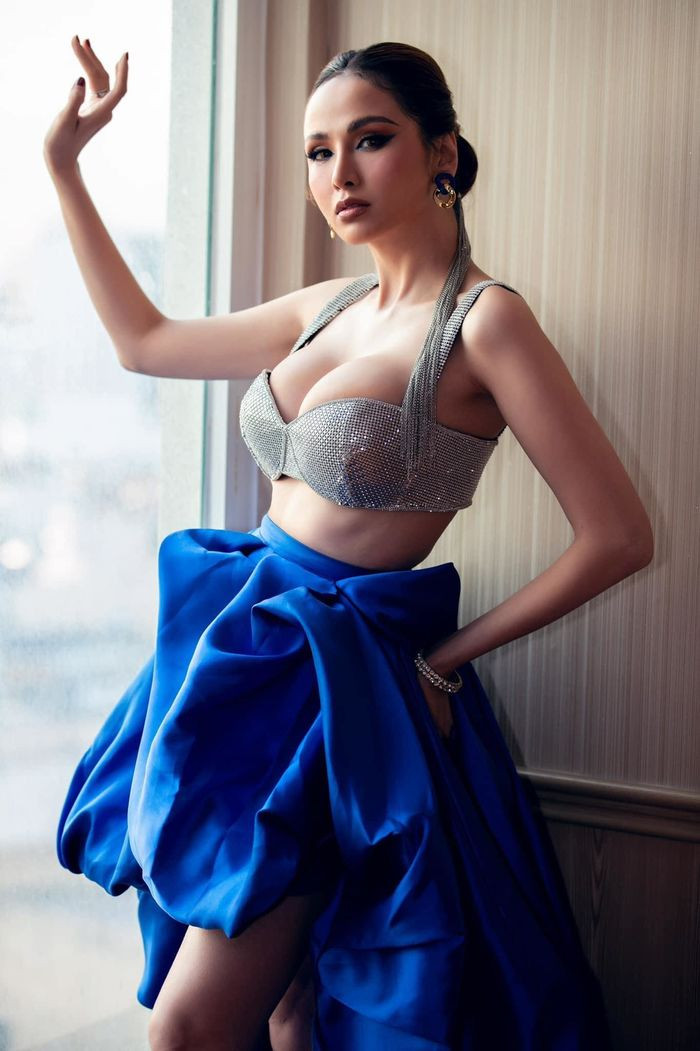 Tăng size vòng 1 bất thường, Kỳ Duyên thừa nhận đã thẩm mỹ - Hình 2 Tang size vong 1 bat thuong, Ky Duyen thua nhan da tham my-Hinh-2