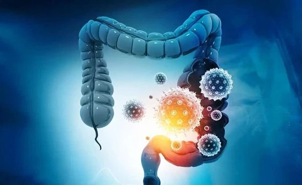 Khi ung thu ruot xuat hien co the se co 3 nhieu, 2 dau