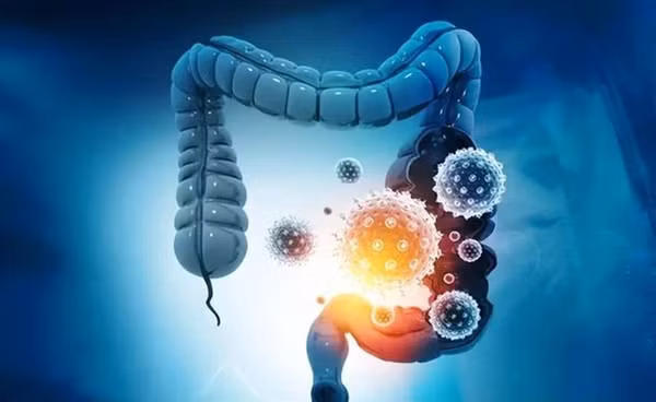 Khi ung thu ruot xuat hien co the se co 3 nhieu, 2 dau