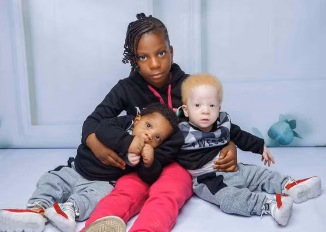 Để truyền cảm hứng tới cho mọi người, Stacy thường xuyên chia sẻ câu chuyện của 2 con trên mạng. Chỉ sau một năm, tài khoản của Daniel và David cán mốc 18.000 người theo dõi.