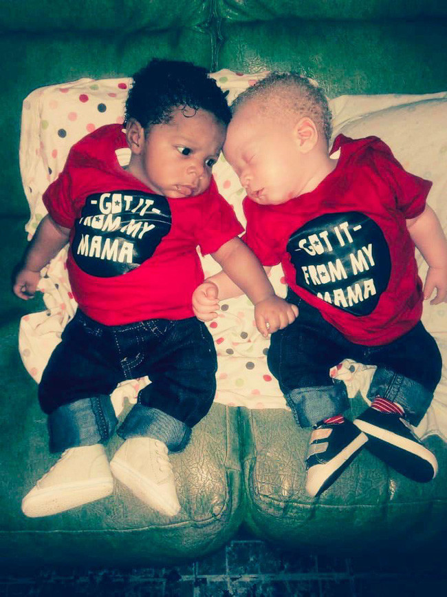 Những kiểm tra sau đó xác định David mắc bệnh bạch tạng. Cơ thể em bẩm sinh thiếu hắc tố melanin, phân tử tạo nên màu đen ở da, tóc. Cha của David, anh Babajide, gọi em với cái tên thân thương Mr Golden (cậu bé vàng). May mắn, David không gặp biến chứng về sức khỏe.