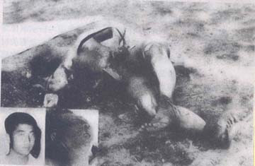 Một trong chín nạn nhân cháy biến dạng trên chiếc chuyên cơ Trident 256.