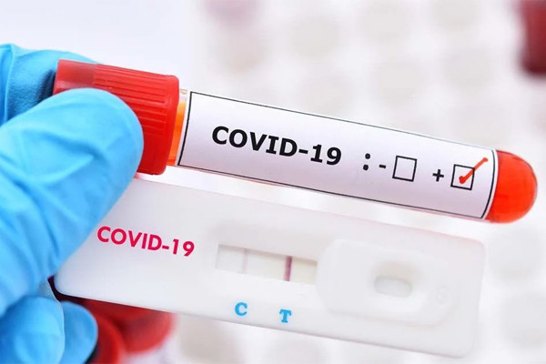 Ly giai su lay nhiem cua 2 ca Omicron tiem du vac xin, o phong rieng