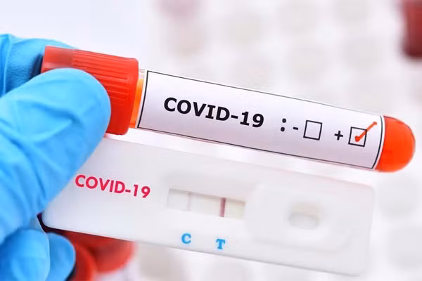 Ly giai su lay nhiem cua 2 ca Omicron tiem du vac xin, o phong rieng