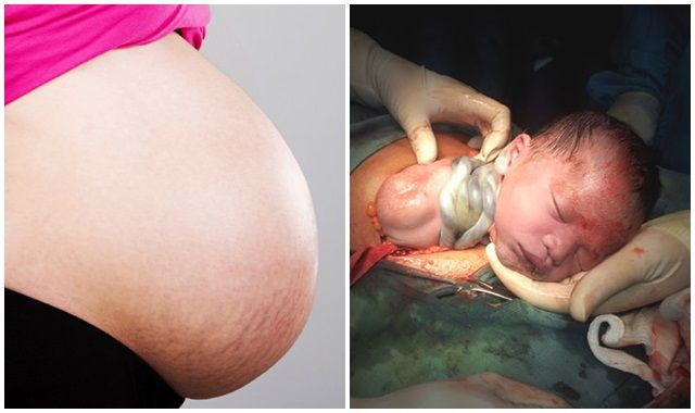 Thói quen của mẹ bầu dễ khiến thai nhi bị dây rốn quấn cổ Thoi quen cua me bau de khien thai nhi bi day ron quan co