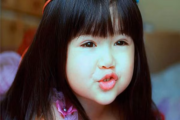 Tiếp xúc với Toluene qua đường hô hấp sẽ gây nên các biểu hiện tổn thương chủ yếu của hệ thần kinh trung ương như: nhức đầu, nôn mửa, chóng mặt, buồn ngủ, loạng choạng cùng những biểu hiện như khi say rượu. Trường hợp nặng có thể mất ý thức và tử vong. Sự tiếp xúc với hóa chất này càng lâu dài thì các biểu hiện trên càng nặng.