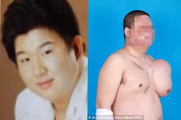 Anh Yan Jianbin trước và sau khi bị điện giật.