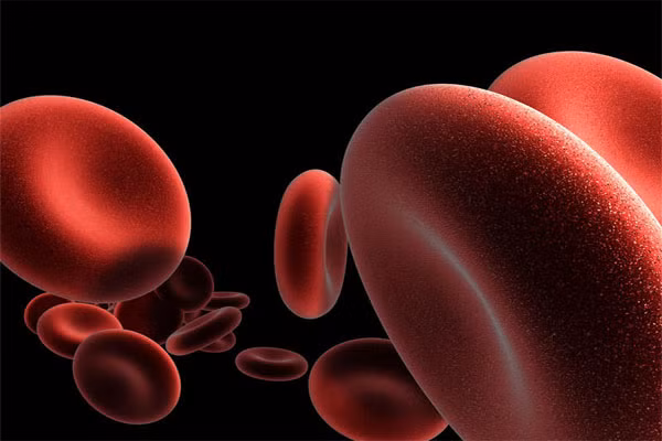 Vết màu tím hay các vết dơ. Rất giống những vết bầm, và thường bị lầm lẫn với các vết bầm, nhưng lại tồn tại lâu hơn. Có vài nguyên nhân, từ bệnh xuất huyết cho đến bệnh scurvy (do thiếu vitamin C). Bắt đầu từ màu đỏ, rồi chuyển sang tím, tồn tại lâu hơn một vết bầm, trước khi nhạt dần và sau cùng là mầu nâu.