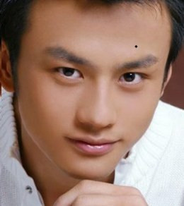 Người đàn ông có thiên đình đầy đặn , nếu phát hiện có nốt ruồi đen vừa to vừa sáng ở nơi gần đường viền tóc trên trán, thì đó là dấu hiệu của phúc lộc, kì thực nó cũng cho biết gia cảnh người đàn ông rất tốt, nhưng nếu nốt ruồi này trở nên xám màu thì lại mang ý nghĩa ngược lại.