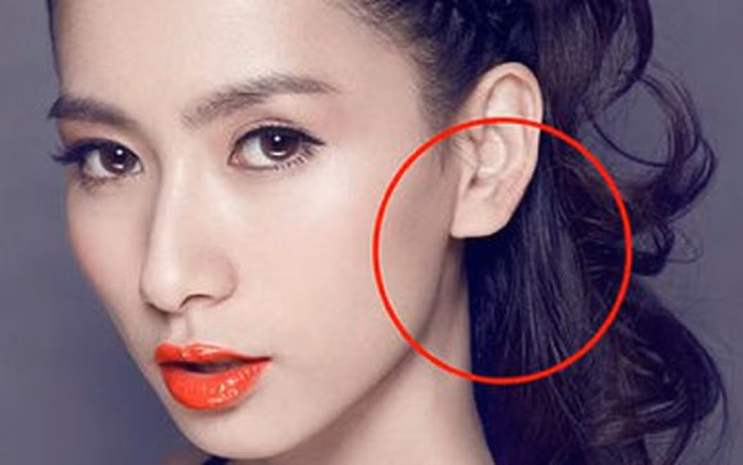  Tất nhiên, tai của người bình thường không thể có dái tai quá béo, nhưng chỉ cần hình dạng của dái tai đầy đặn là đủ cho thấy sự nghiệp, tài lộc và vận khí của bản thân đều rất ổn định, có thể đạt được thành tích tốt trong kinh doanh hoặc các vị trí cao.