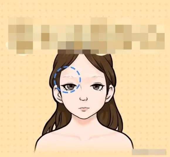 Sở hữu khuôn mặt như vậy tượng trưng cho sự kiên trì, coi trọng lợi ích của bản thân và dễ xảy ra mâu thuẫn với người khác. Anh ấy có tính cách thiếu kiên nhẫn, nói thẳng, không có nhiều bạn bè và giúp đỡ tương đối ít trong sự nghiệp.