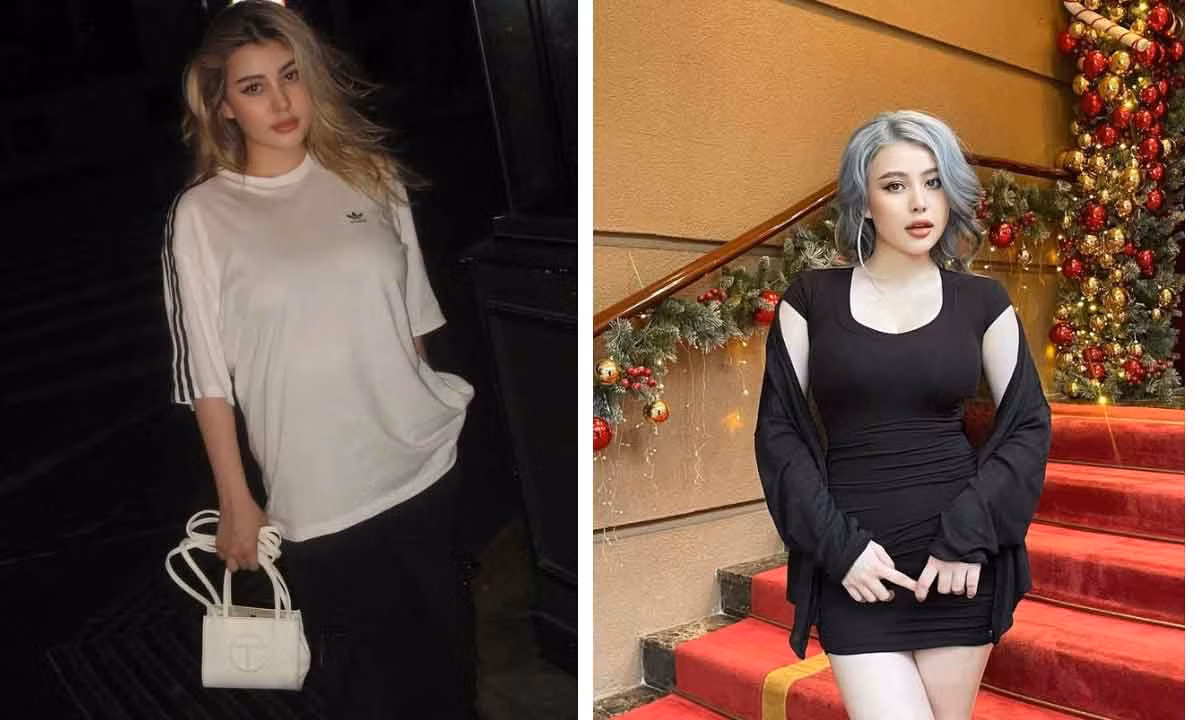 Hot girl Sunna phau thuat tham my sau 1 nam sinh con