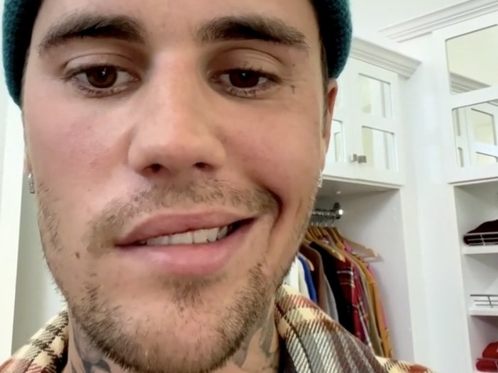 Can benh cua Justin Bieber