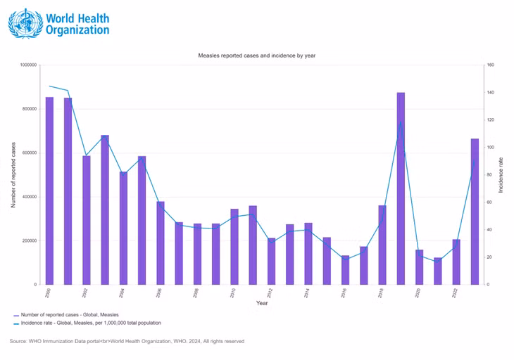 Biểu đồ tình hình nhiễm sởi trên thế giới - Ảnh minh họa