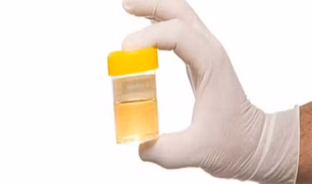 Vào thời Trung Cổ, các thầy thuốc thường chẩn đoán bệnh bằng cách ngửi, kiểm tra và thậm chí nếm thử nước tiểu của bệnh nhân.