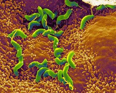 Trong 8 - 10 ngày tiếp theo, vi khuẩn ẩn náu bên trong cơ thể người xấu số như ở ruột sẽ phát triển và ăn các mô chết. Chính vì vậy, chúng đã giải phóng ra putrescine và cadaverine - những hợp chất làm cho cơ thể có mùi sau khi chết. Do đó, thi thể bắt đầu bốc ra mùi khó chịu.